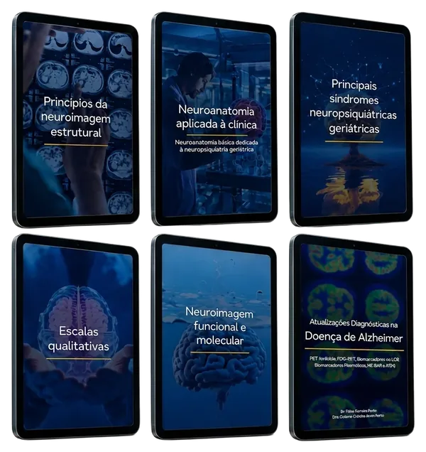 Capas de 6 livros digitais em tablets: Princípios da neuroimagem estrutural, Neuroanatomia aplicada à clínica, Principais síndromes neuropsiquiátricas geriátricas, Escalas qualitativas, Neuroimagem funcional e molecular e Atualizações Diagnósticas na Doença de Alzheimer